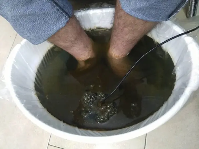 سم زدایی بدن از طریق پا 564564510