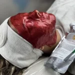 ماسک دو فاز شراب قرمز بست کلین کره45687678