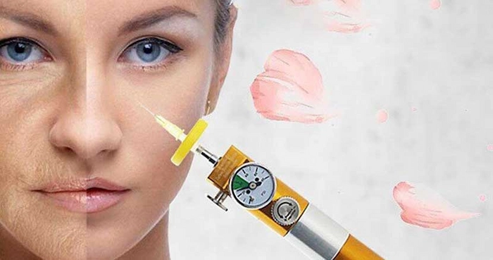 کاربرد کربوکسی تراپی 4657