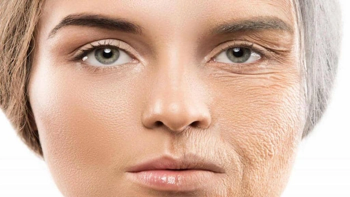 تاثیر هایفو بر قسمت های مختلف صورت 44