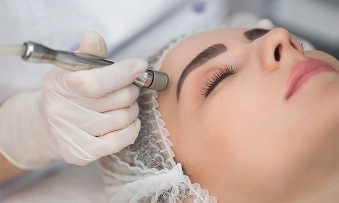 فیشیال لایه‌برداری و میکرودرم ابریژن 6416854