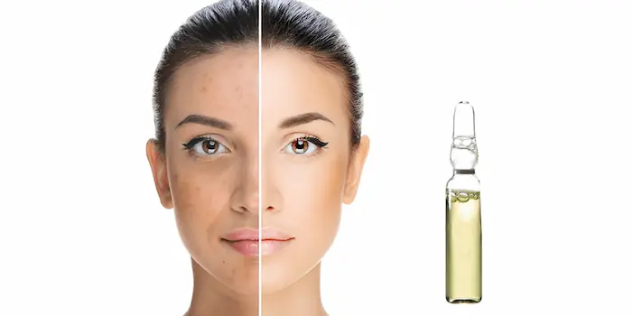 ویال‌ تراپی پوست و کاربرد های آن 983764773