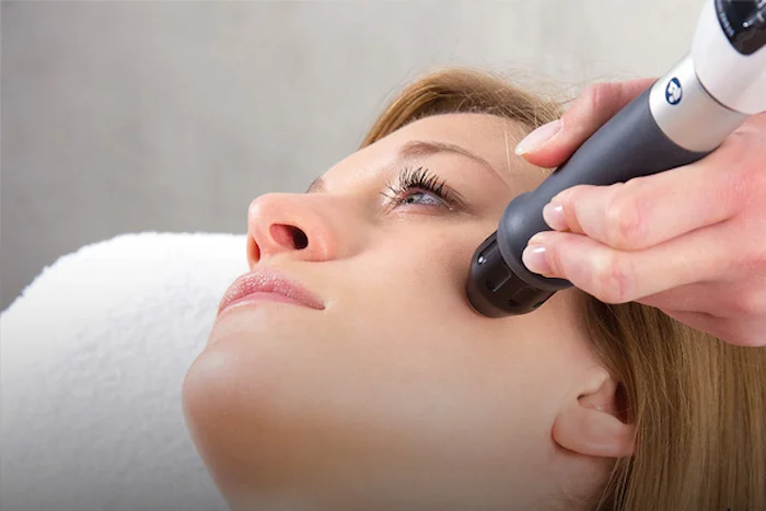جونسازی پوست با پلاژن‌ تراپی 564564645120