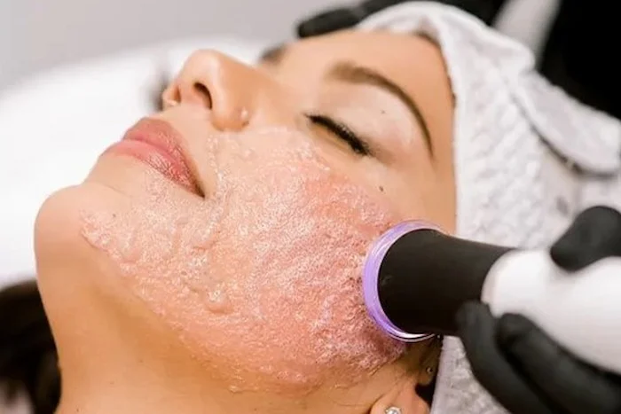 جوانسازی با پلاژن‌ تراپی در کلینیک 545210564650