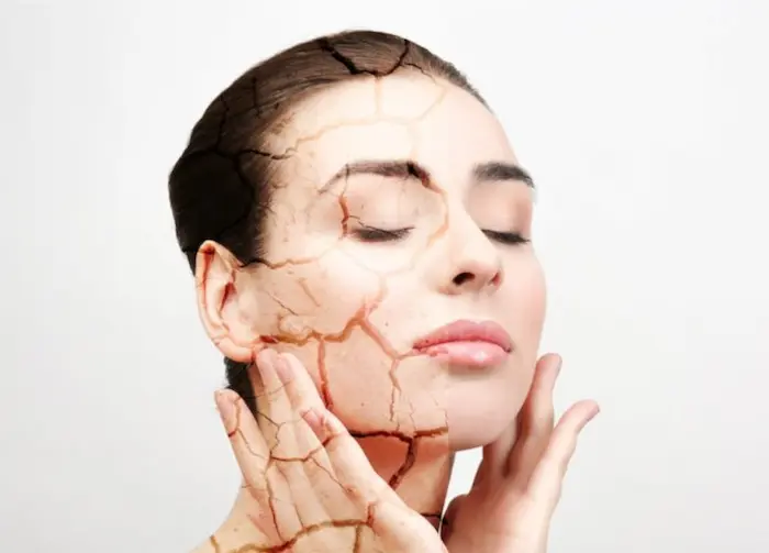 جلوگیری از کشیدگی پوست صورت 5454777