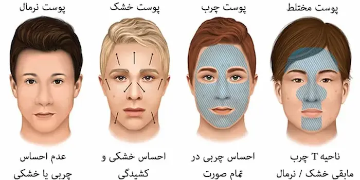 شناخت خصوصیات انوع پوست 654658945120