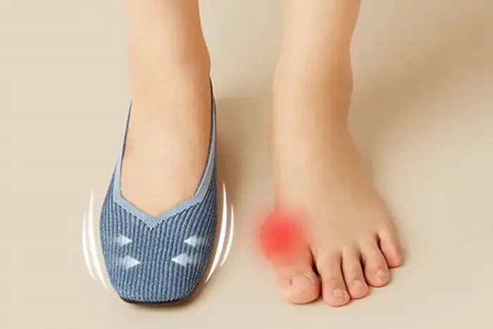 میخچه زدن پا باپوشیدن کفش تنگ 54534523