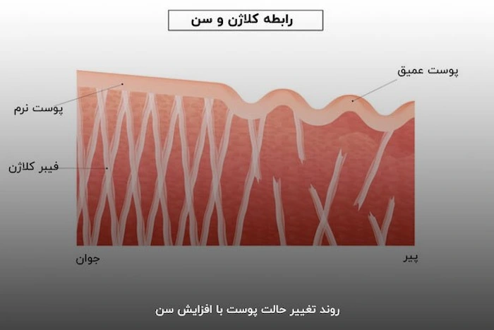 سن شروع کلاژن سازی 646464
