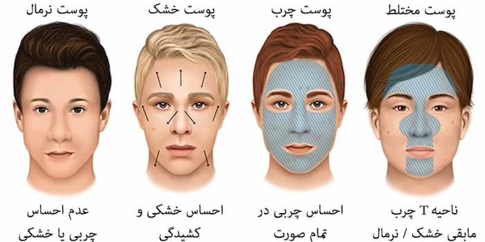 انواع پوست 4165416985