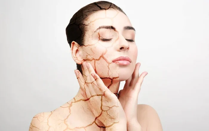 ایجاد خشکی و ترک پوستی 56465210