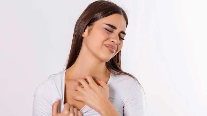 خارش شدید پوستی 56456410