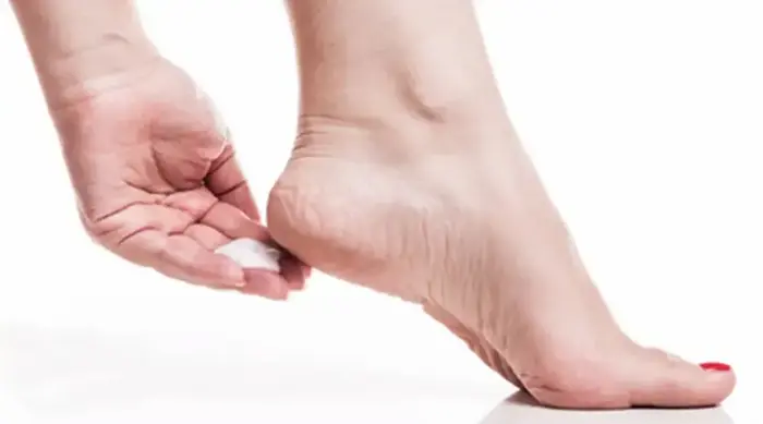 استفاده از کرم و روغن برای رفع ترک پاشنه پا در هوای سرد 563543543