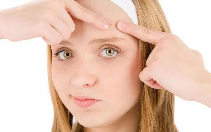 دلایل بروز جوش پیشانی 444353434