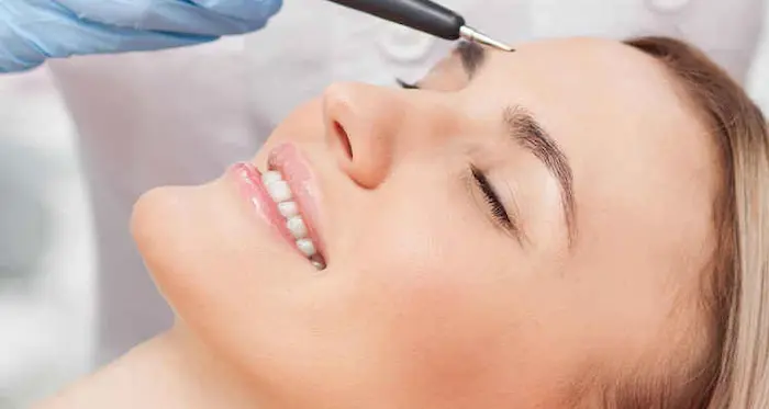 انجام دادن الکترولیز برای موهای پیشانی 543534534