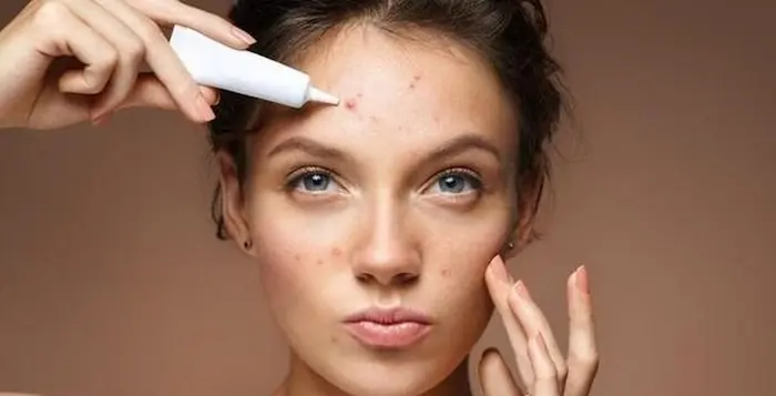 استفاده از تونر برای رفع جوش پیشانی 45634543543