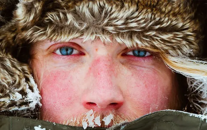 پیری زودرس وخشکی پوست در زمستان 563543534