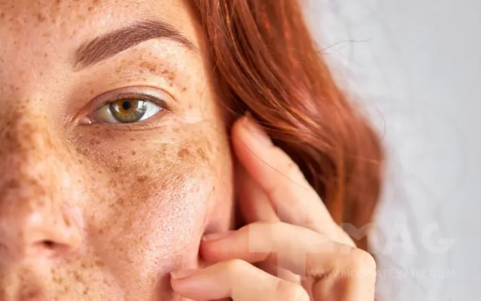 انواع رنگ لک ملاسما 35434534543