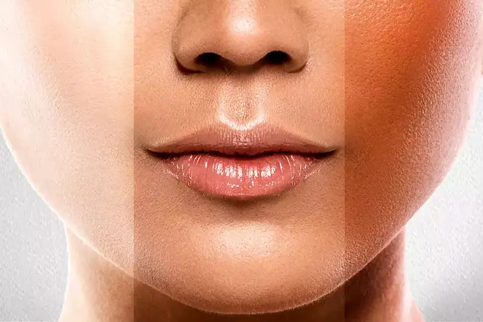 ملانین پوست و اختلاف رنگی صورت 563453543