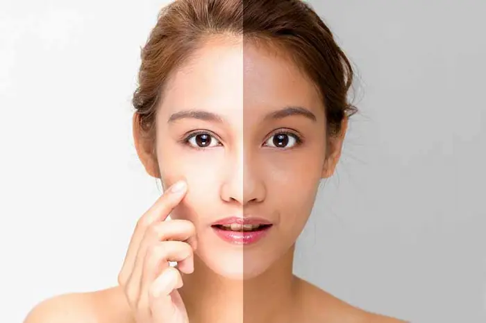 مقایسه پوست با ملانین وبدون ملانین 454354324