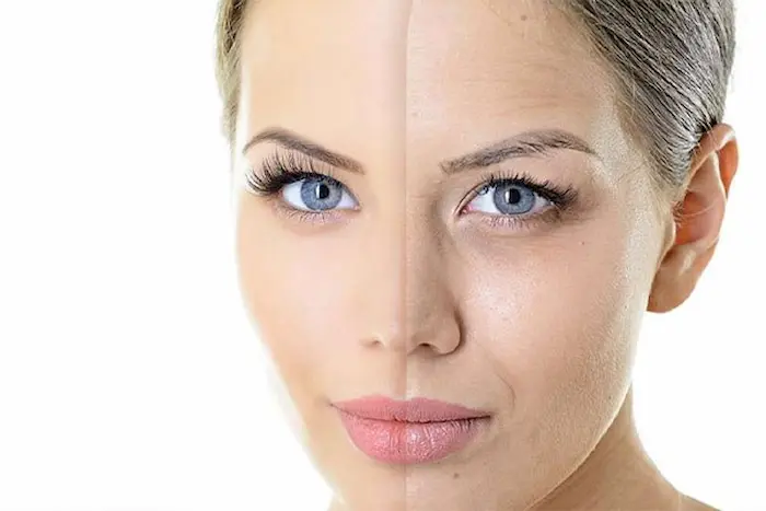 تاثیر پی آر پی صورت43534534534