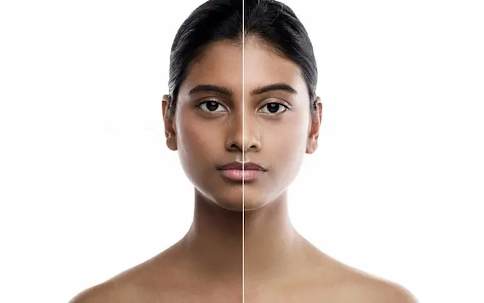 رفع تیرگی پوست 434345