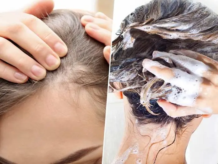 استفاده از شامپو و ماسک برای رفع ریزش مو 5645654