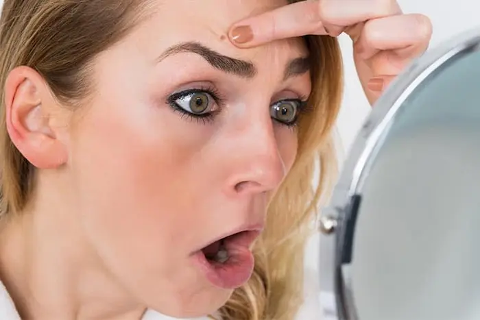 جوش زدن پیشانی صورت بعد از آرایش زیاد 5474567456