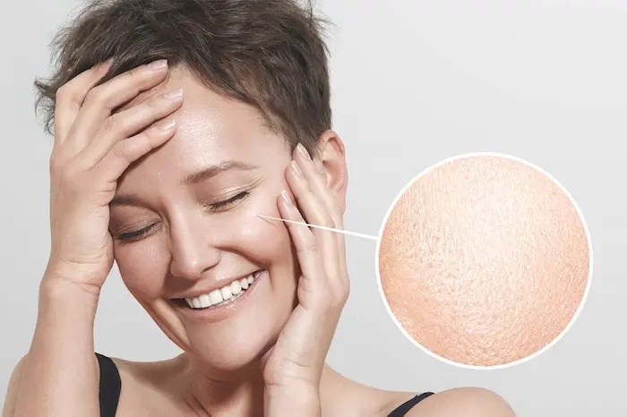 رفع منافذ باز صورت 564654654