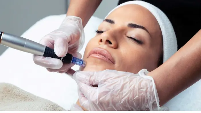 استفاده از دستگاه میکرونیدلینگ روی پوست 54654654