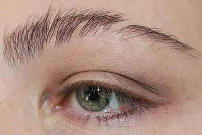 پیشگیری از ریزش ابرو 65465465