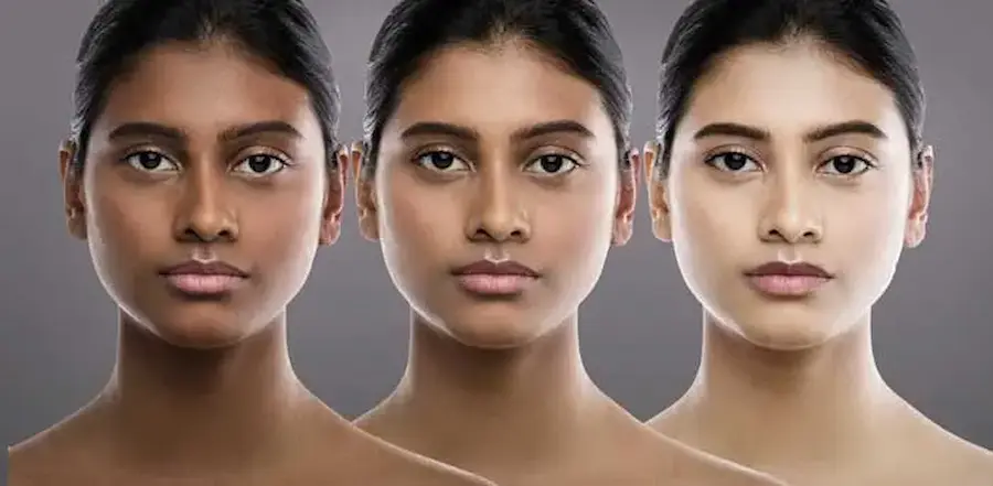 راه های سفید شدن تدریجی پوست 676866