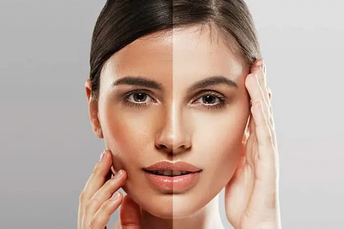 سفید شدن پوست 765432