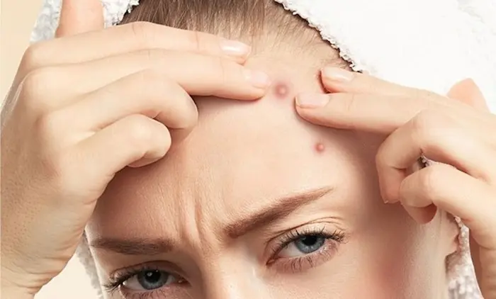 تشخیص خال سرطانی روی صورت 54654654