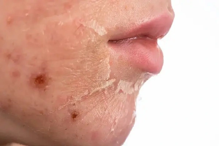 لک و جوش با تونر 32432454541